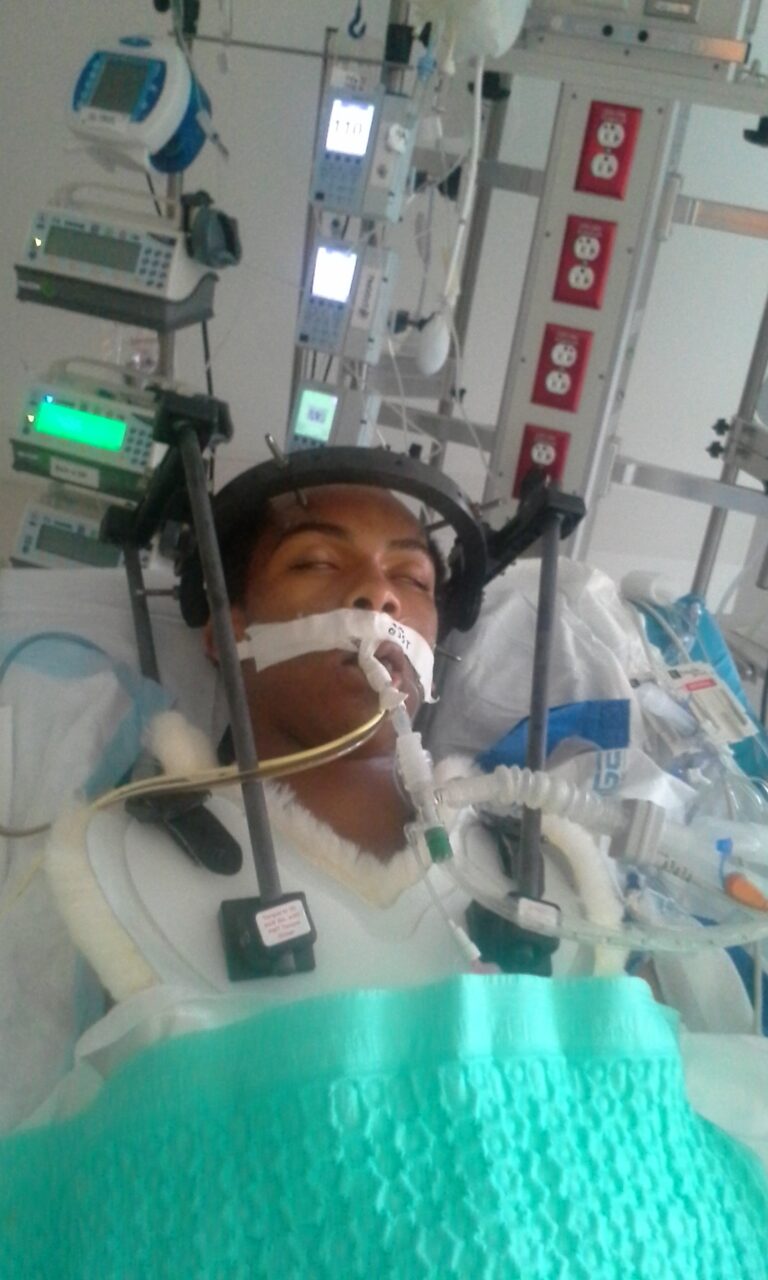 Abyir survived the Ventilator